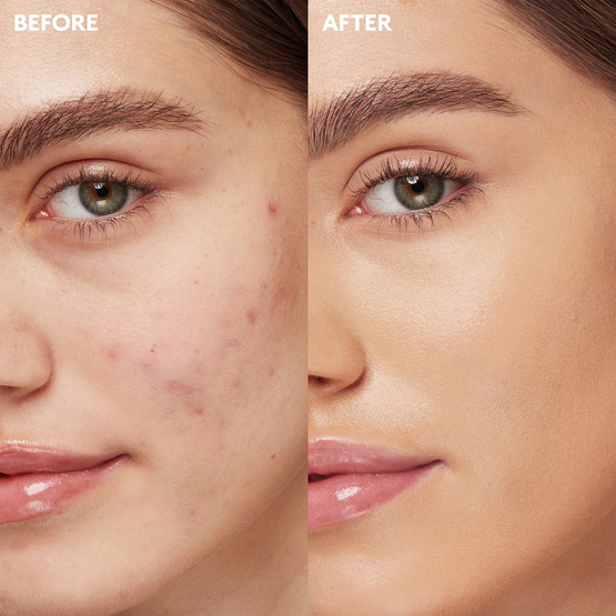 KIKO Milano Full Coverage 2-In-1 Foundation & Concealer mocno kryjący podkład i korektor 2 w 1 Warm Beige 15 25ml